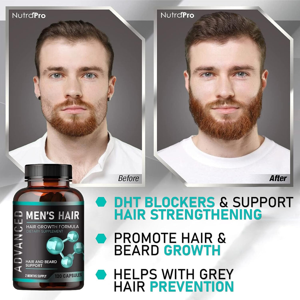 Hair Growth Vitamins for Men, Anti Hair Loss Pills with Biotin and Saw Palmetto, 120 Caps H973